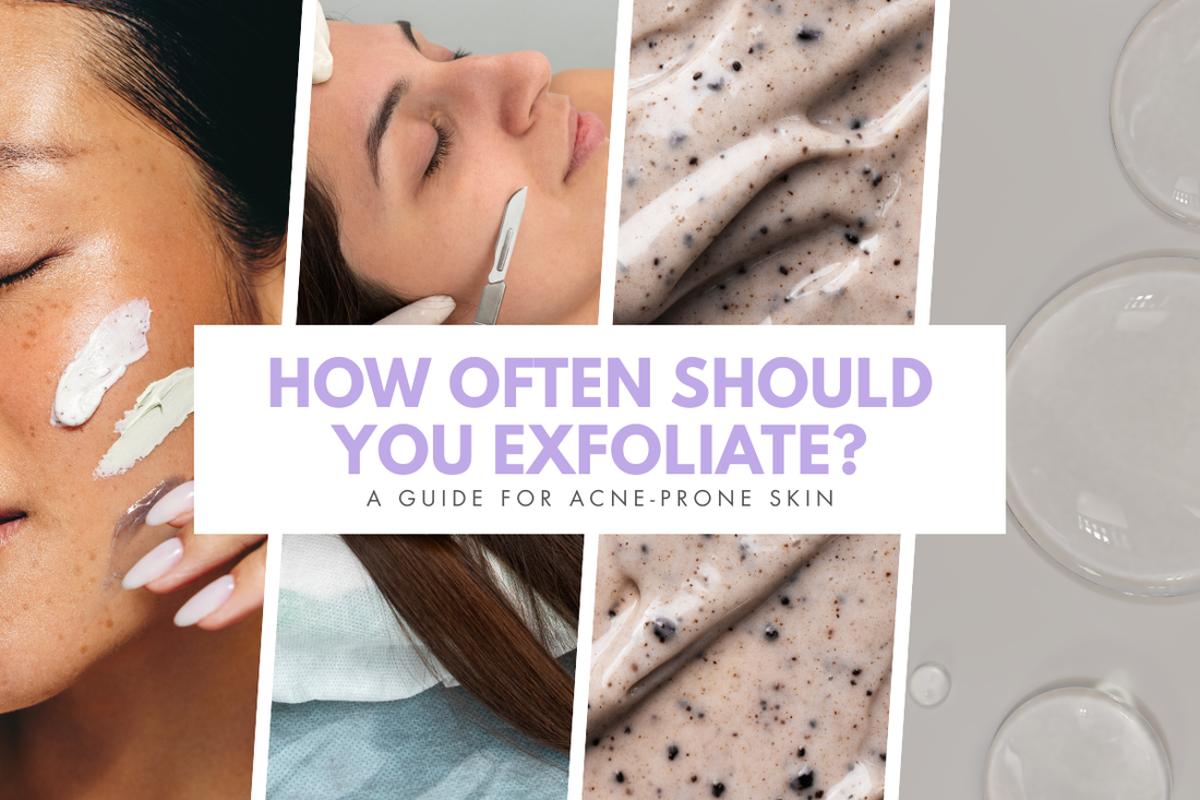 How Often Should You Exfoliate? A Guide for Acne-Prone Skin