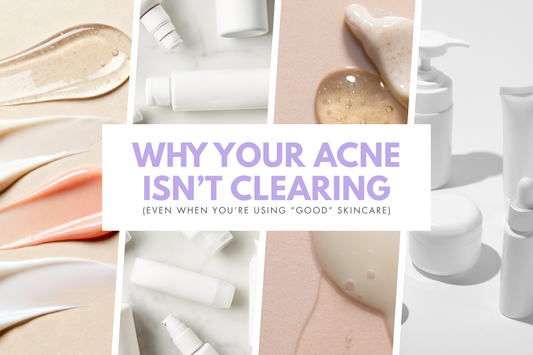 Why Your Acne Isn’t Clearing (Even When You’re Using “Good” Skincare)