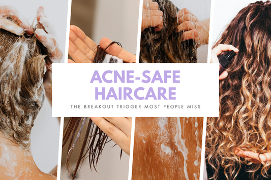Acne-Safe Haircare: The Breakout Trigger Most People Miss